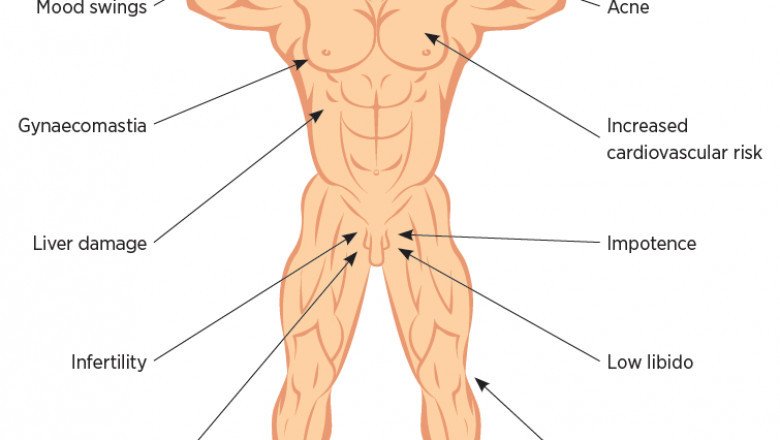 Adverse Effect Of Steroids on Human Health