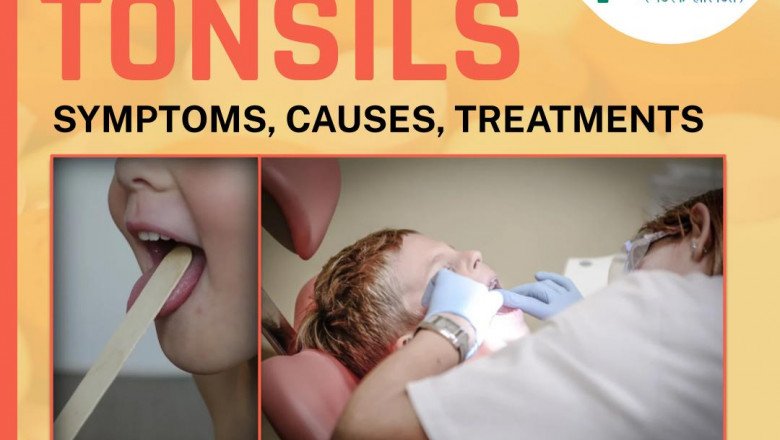 Tonsil Stones: Causes, Symptoms, and Treatment Options