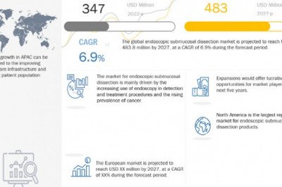 Endoscopic Submucosal Dissection Market worth $483 million by 2027 : Know the Advantages and Latest Trends in the Industry