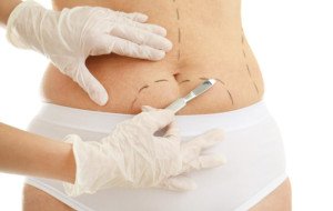 What Is Power-Assisted Liposuction Uae?