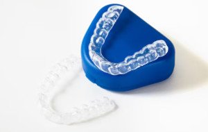 Upper Acrylic Partial Denture and Retainers for Teeth: A Practical Guide to Comfort and Dental Support