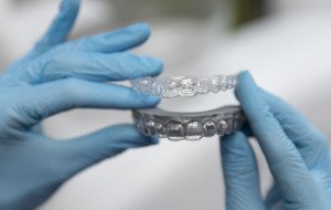 Clear Aligners in Chandigarh: Cost, Process &amp; Expert Care