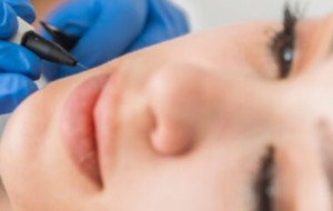 Dermapen Facial Twickenham for Skin Rejuvenation Care Advice