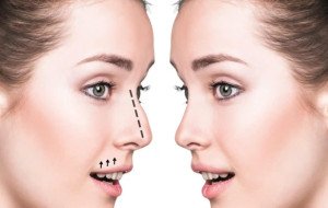 Best Doctors in Dubai for Rhinoplasty: Making an Informed Decision