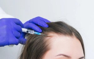 Get Personalized Care With Stem Cell Hair Transplant in Dubai